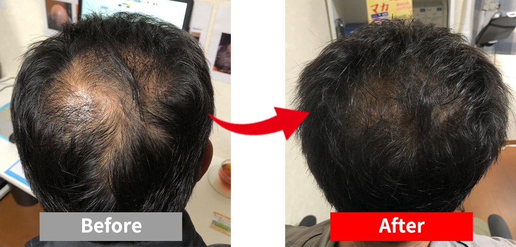 ビフォーアフター写真